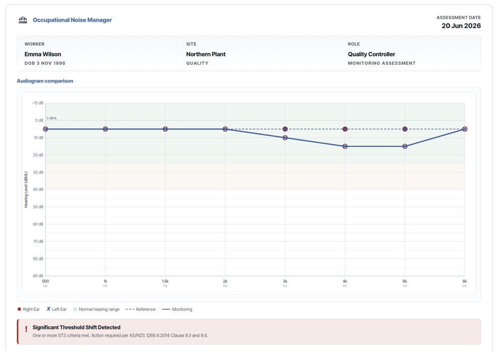 An assessment report comparing reference and monitoring audiograms, with a significant threshold shift flagged per AS/NZS 1269.4